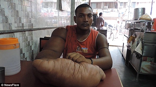 Anh Bablu bị cả gia đình và dân làng kì thị chỉ vì có dị tật ở cánh tay. (Ảnh: Internet)