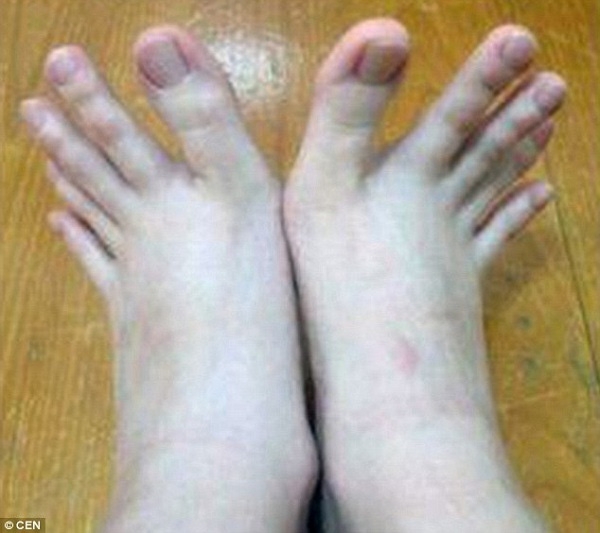Những ngón chân nhìn qua nhiều người lầm tưởng là ngón tay.