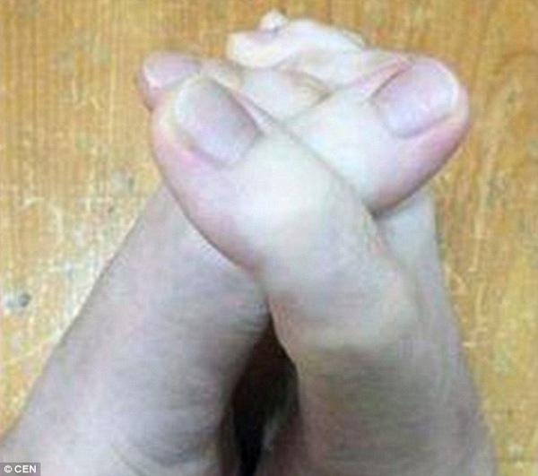 Các ngón chân dài đến mức có thể đan xen vào nhau như hai bàn tay.
