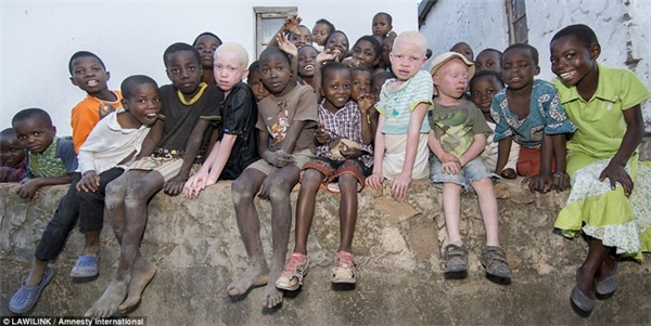 Thảm cảnh những đứa trẻ bạch tạng châu Phi bị giết hại để lấy bộ phận cơ thể làm tà thuật