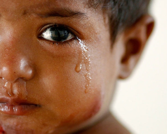 Amira, nạn nhân của cơn lũ kinh hoàng bị mắc bệnh về da và dạ dày, bật khóc ở bệnh viện Sukkur. Nhiều người lo ngại rằng hàng trăm ngàn em bé được sinh ra ở các khu vực bị ảnh hưởng lũ lụt của nước này trong vòng 6 tháng tới, sẽ có nguy cơ suy dinh dưỡng nghiêm trọng vì khan hiếm lương thực.