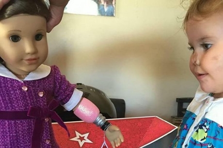 Cô bé 2 tuổi bị cụt tay chân tìm lại nụ cười nhờ món quà đặc biệt