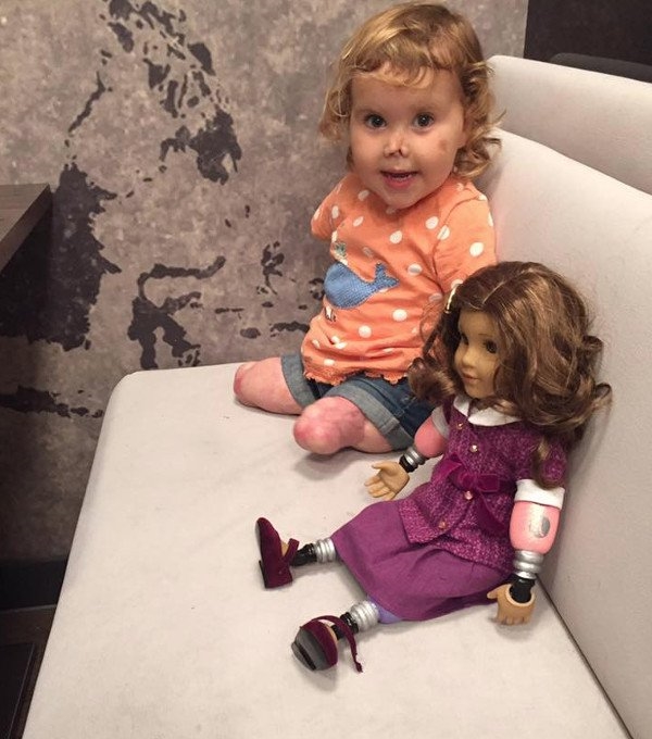 Cô bé 2 tuổi bị cụt tay chân tìm lại nụ cười nhờ món quà đặc biệt