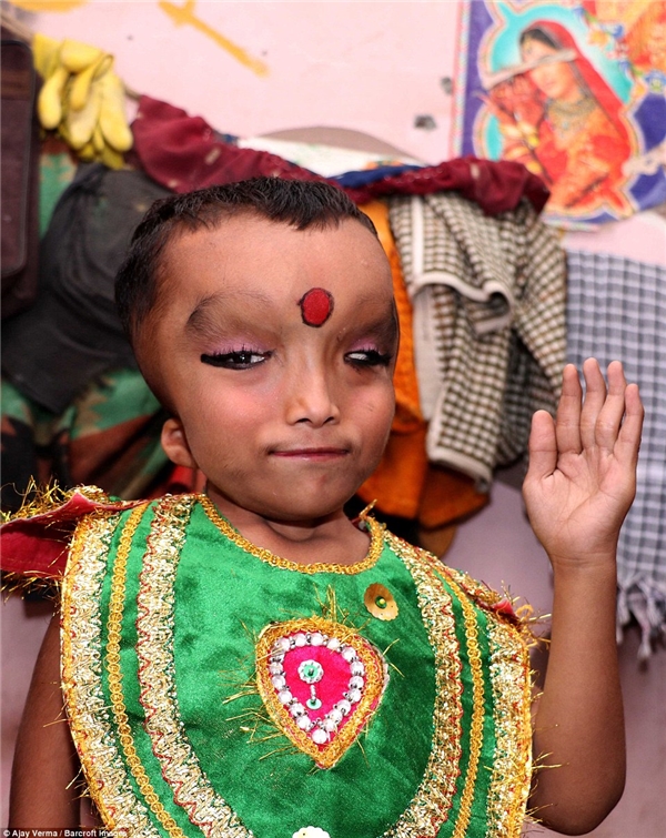 Tại Ấn Độ, cậu bé có vẻ ngoài kì lạ này được tôn làm thần linh
