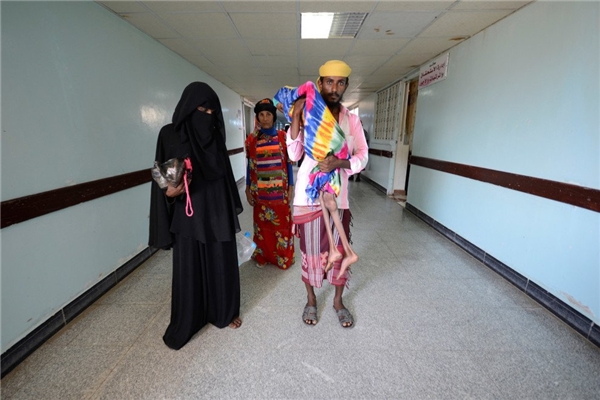 Baghili được người thân đưa đến chữa trị chứng suy dinh dưỡng cấp tính tại bệnh viện al-Thawra.