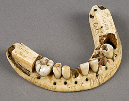 Bạn có thể tin được không, ngày xưa khi khoa học chưa phát triển như bây giờ, những nha sĩ có tiếng để có thể “thay răng” cho bệnh nhân, họ đã lấy răng của những binh linh tử trận nơi chiến trường để cấy ghép vào. 