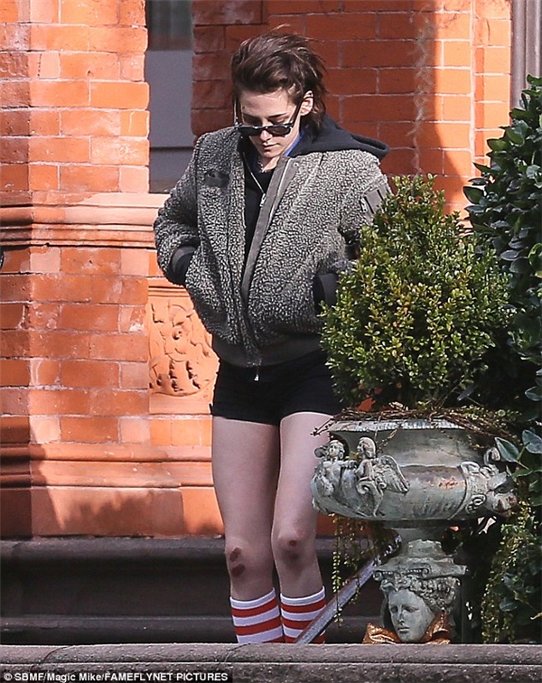 Kristen mặc quần short để lộ hai đầu gối chấn thương.