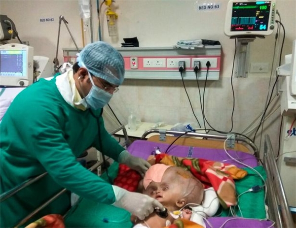 Cảm thông với gia đình Mrityunjay, các bác sĩ đến từ hiệp hội y tế và khoa học Ấn Độ (AIIMS) đã tài trợ 6.000 bảng Anh (khoảng hơn 166 triệu VNĐ) cho ca phẫu thuật hút dịch não nhằm mang phép màu đến cho cậu bé chưa đầy 10 tháng tuổi này.