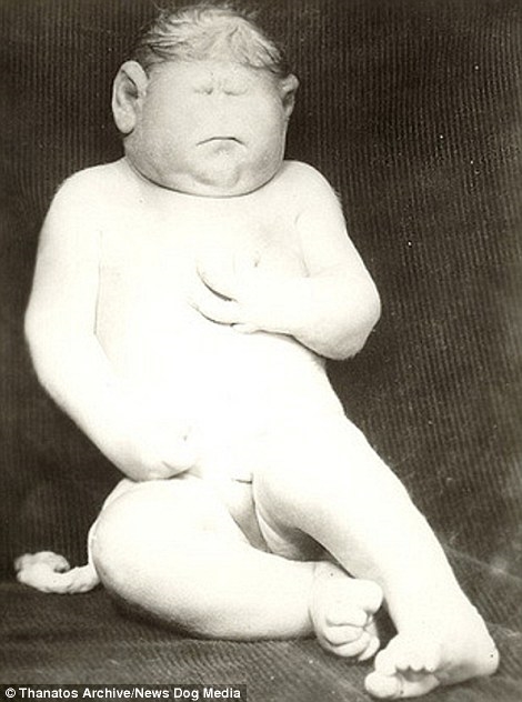 Nhiều trẻ sơ sinh không may sinh ra dị dạng mặc dù đã chết nhưng vẫn đem ra trong các show diễn. Trên ảnh là một cậu bé sinh ra tại Illinois năm 1939. Cậu bé nặng 13,6kg, không mắt, có đuôi và đôi tai lớn bất thường.