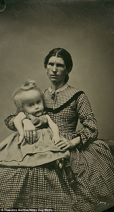 Một người mẹ chụp ảnh cùng cô con gái có chiếc đầu ngoại cỡ.