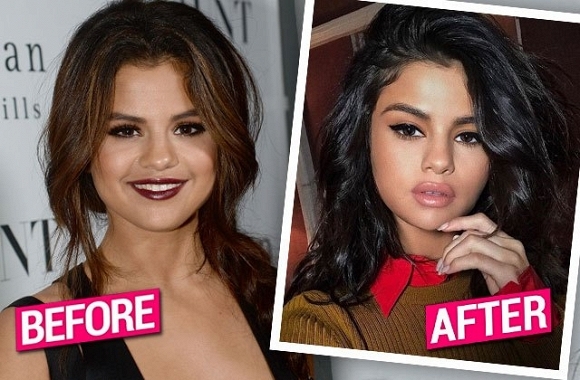 Hình ảnh khác biệt về đôi môi của Selena Gomez làm dấy lên nghi vấn cô đã tiến hành bơm môi.