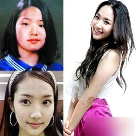 
	
	Người đẹp nổi tiếng dao kéo trong City Hunter – Park Min Young là người đi tiên phong trong việc biến "vịt thành thiên nga" tại Hàn Quốc. Rất nhiều cô gái trẻ khi nhìn vào hình ảnh trước và sau của Park Min Young và đã đi theo con đường của ngôi sao này.