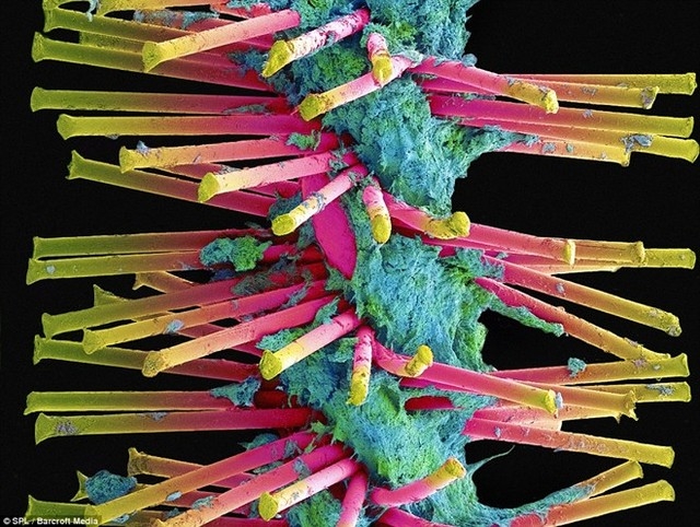 Hình dạng vi khuẩn bám trên răng người