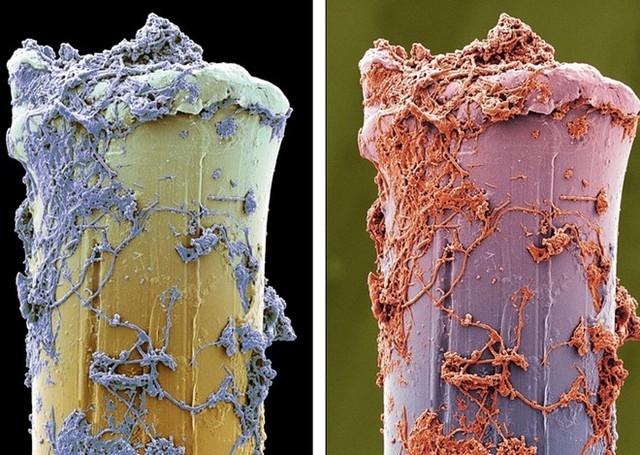 Hình dạng vi khuẩn bám trên răng người