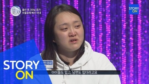 
	
	Kim Jin khi chưa phẫu thuật thẩm mỹ sở hữu gương mặt tròn và không mấy xinh đẹp.