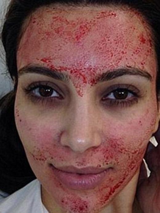 
	
	Khuôn mặt sau khi chăm sóc da được ví như ma cà rồng của Kim Kardashian.