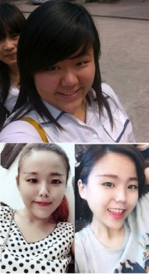 
	
	Cô nàng Minh Châu trước và sau khi giảm cân