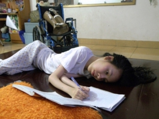 
	
	Cô gái xương thủy tinh Nguyễn Thị Nguyện