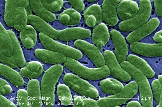 
	
	Vi rút Vibrio vulnificus khiến nhiều người hoảng sợ
