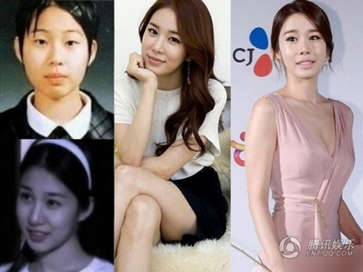 
	
	Yoo In Na: Sau quá trình thẩm mỹ, cô đẹp hơn nhưng ngày càng giống ma-nơ-canh