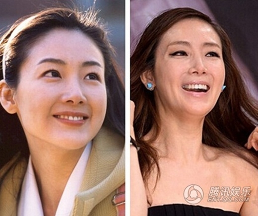 
	
	Choi Ji Woo: Vẻ đẹp của cô bị đặt nghi vấn vì sự xuống dốc trầm trọng.