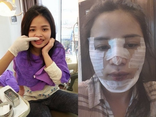 
	
	Nữ thạc sĩ chia sẻ hình ảnh phẫu thuật thẩm mĩ toàn bộ gương mặt khiến dân mạng xôn xao. (Nguồn: Facebook)