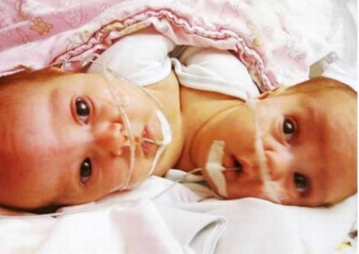 
	
	Cặp song sinh của vợ chồng ở phía bắc Illinois, Mỹ này cực kì đặc biệt bởi hai bé sinh vào 2 năm khác nhau: bé đầu cất tiếng tiếng khóc chào đời vào phút cuối cùng của năm 2010 và bé thứ hai ra đời ở phút đầu tiên của năm 2011. (Ảnh: Internet)