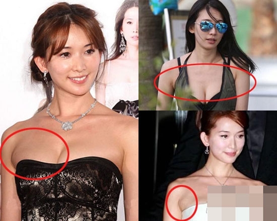 
Siêu mẫu Lâm Chí Linh từng đỏ mặt khi báo chí "zoom" kĩ vào khu vực dưới cánh tay của cô.