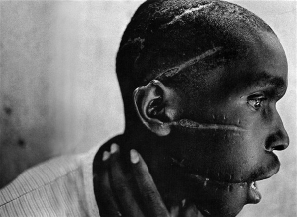 
Một người đàn ông trẻ tuổi từ Rwanda cho thấy những vết sẹo khi còn trong một trại tử thần.