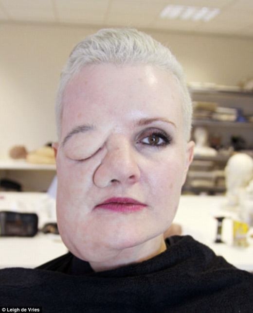 
Leigh de Vries hóa trang để thu thập phản ứng những người xung quanh về khuôn mặt dị dạng của mình. (Ảnh: Internet)
