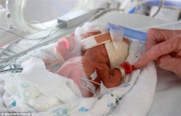 
Bé Grace là con của Michaela Harris, sinh non ở tuần thứ 24 và chỉ nặng 490gam. (Ảnh: Daily Mail)