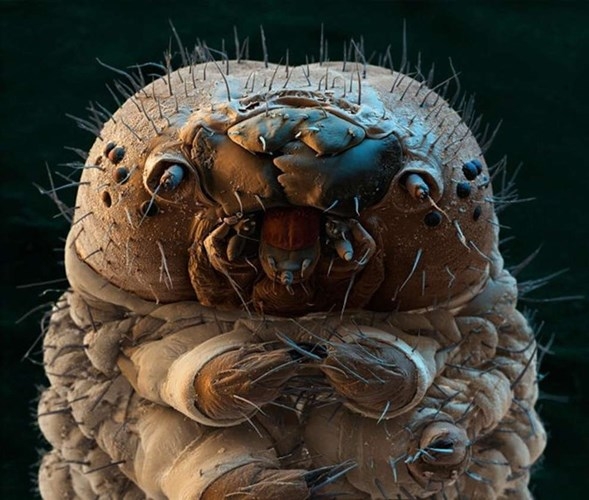 
Chân dung kinh khiếp của sâu bướm dưới kính hiển vi.