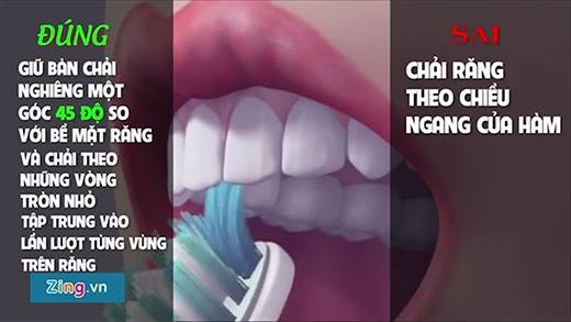 Bạn đã biết cách chăm sóc răng miệng đúng cách?