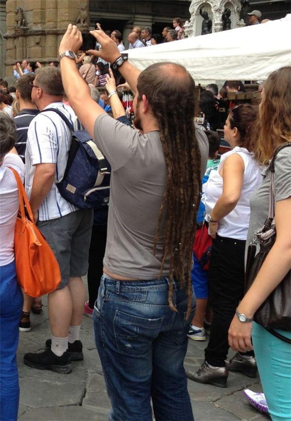 
Người đàn ông tóc dài trọc đầu. (Ảnh: Internet)
