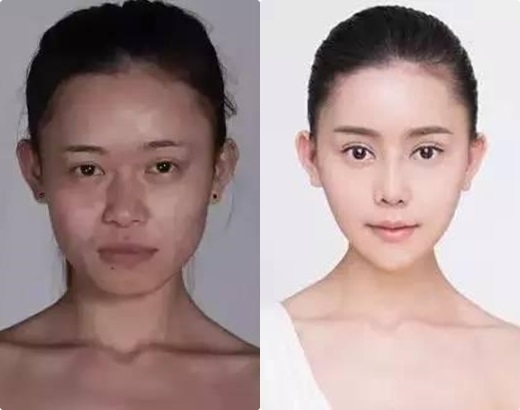 
Cô gái trước và sau phẫu thuật thẩm mĩ (Nguồn Internet)