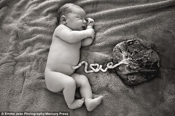 
Bức hình em bé sơ sinh với dây rốn hình chữ Love làm xôn xao mạng xã hội. (Ảnh: Internet)