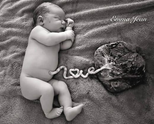 
Mới đây, cộng đồng mạng đã vô cùng xúc động trước hình ảnh em bé ngủ ngon bên túi nhau thai và dây rốn có hình chữ “LOVE”. Khoảnh khắc xúc động này được bà mẹ trẻ Emma Jean Nolan - 30 tuổi, ở Brisbane nước Úc chụp lại. Được biết, cô là một người Maori và dân tộc cô có truyền thống trân trọng nhau thai và dây rốn. (Ảnh: Oddee)