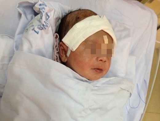
Hình ảnh bé Phát nhập viện vào những tháng trước. Ảnh: Internet
