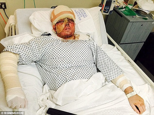 
Hình ảnh Andreas trong bệnh viện sau khi được cấp cứu. (Ảnh: Daily Mail)