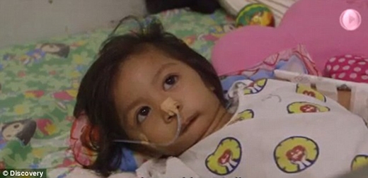 
Cô bé từ lúc ra đời phải được cho ăn bằng ống thông qua đường lỗ mũi. (Ảnh: Internet)