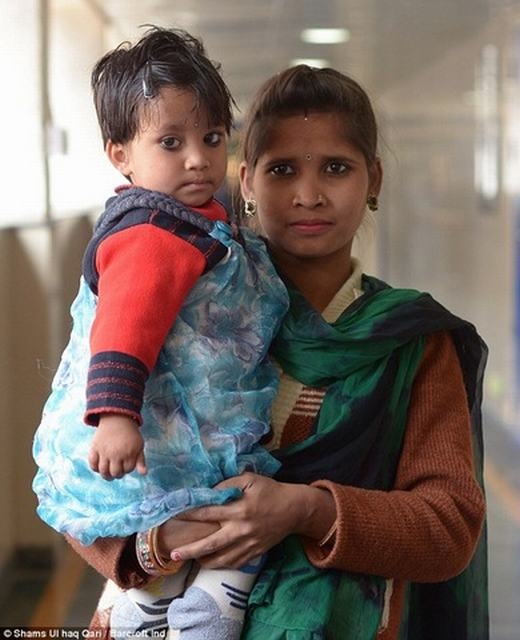 Ấn Độ: Bé gái có chân thứ 3 mọc ở lưng