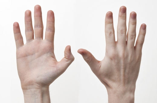 
Bàn tay không có sự chênh lệch nhiều giữa độ dài của các ngón tay (Ảnh: Internet)