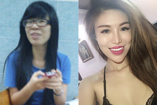 
Hình ảnh trước và sau khi phẫu thuật thẩm mĩ của Trúc Khanh. (Ảnh: Internet)