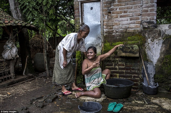 
Người phụ nữ 39 tuổi này hàng ngày vẫn được mẹ già tắm rửa. (Ảnh: Daily Mail)