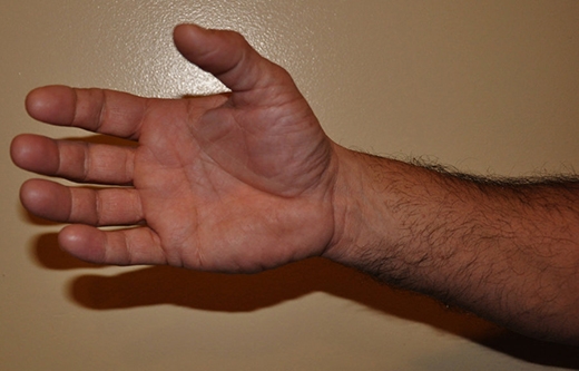 
Bàn tay với các ngón có chiều dài tương xứng và các gò nổi lên tròn đều, đầy dặn (Ảnh: Internet)