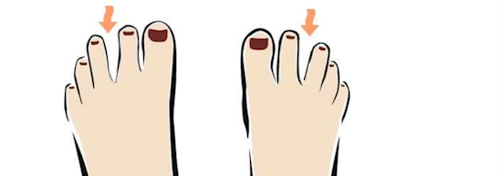 
Ngón chân thứ 2 và 3 cách nhau rõ rệt. (Ảnh: Internet)