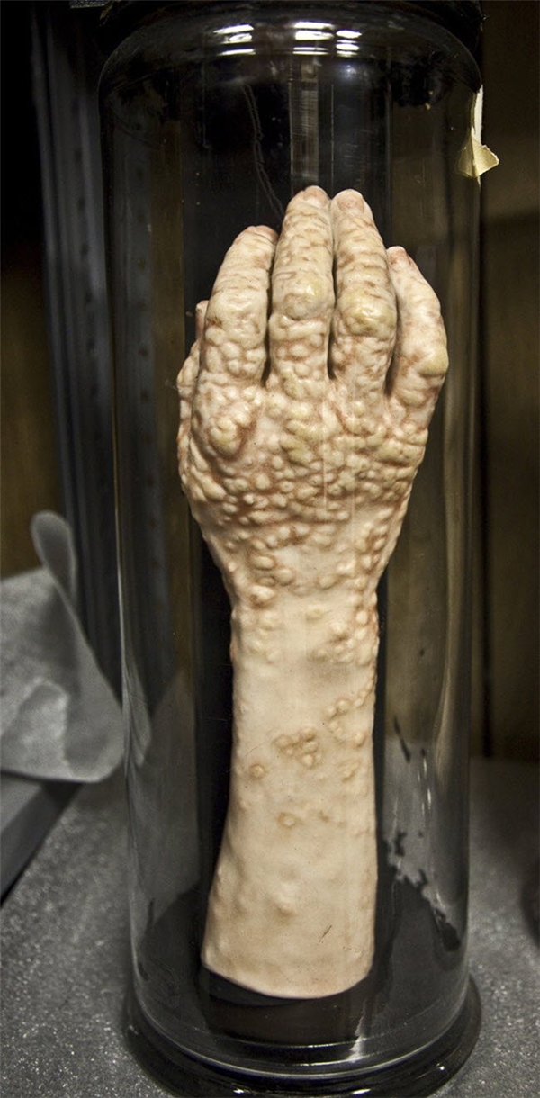 
Bảo tàng Mütter ở bang Pennsylvania của Mỹ là một trong những nơi đáng sợ nhất thế giới. Đây là nơi lưu giữ, trưng bày những bộ phận cơ thể, bào thai và tượng sáp.