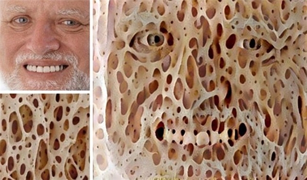 
Khuôn mặt biến dạng như zoombie khi kết hợp hình ảnh một người đàn ông và bọt biển.