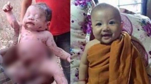 
Em bé được nuôi dưỡng trong ngôi chùa ở Thái Lan là một trường hợp em bé sơ sinh bị bỏ rơi khác, không phải được chú chó cứu sống như nhiều báo điện tử đưa tin.