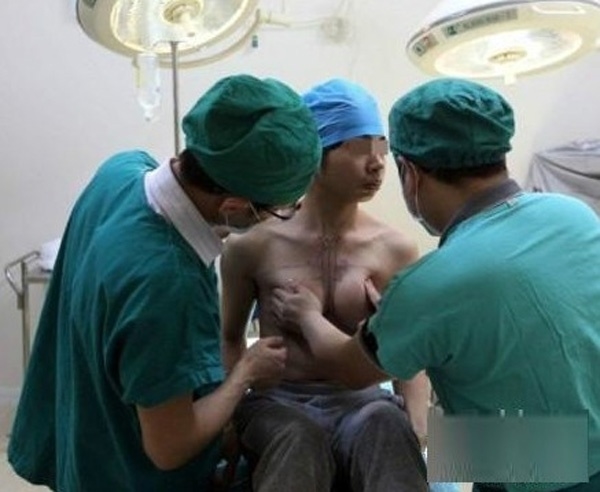 
Bác sĩ vẽ và điều chỉnh để có khuôn ngực hoàn hảo cho người được phẫu thuật. (Ảnh: Internet)